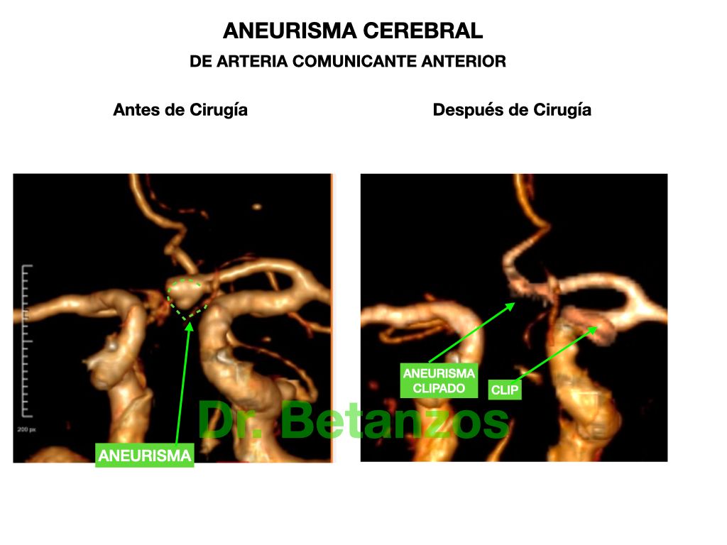 Aleixandre Betanzos Villegas-4