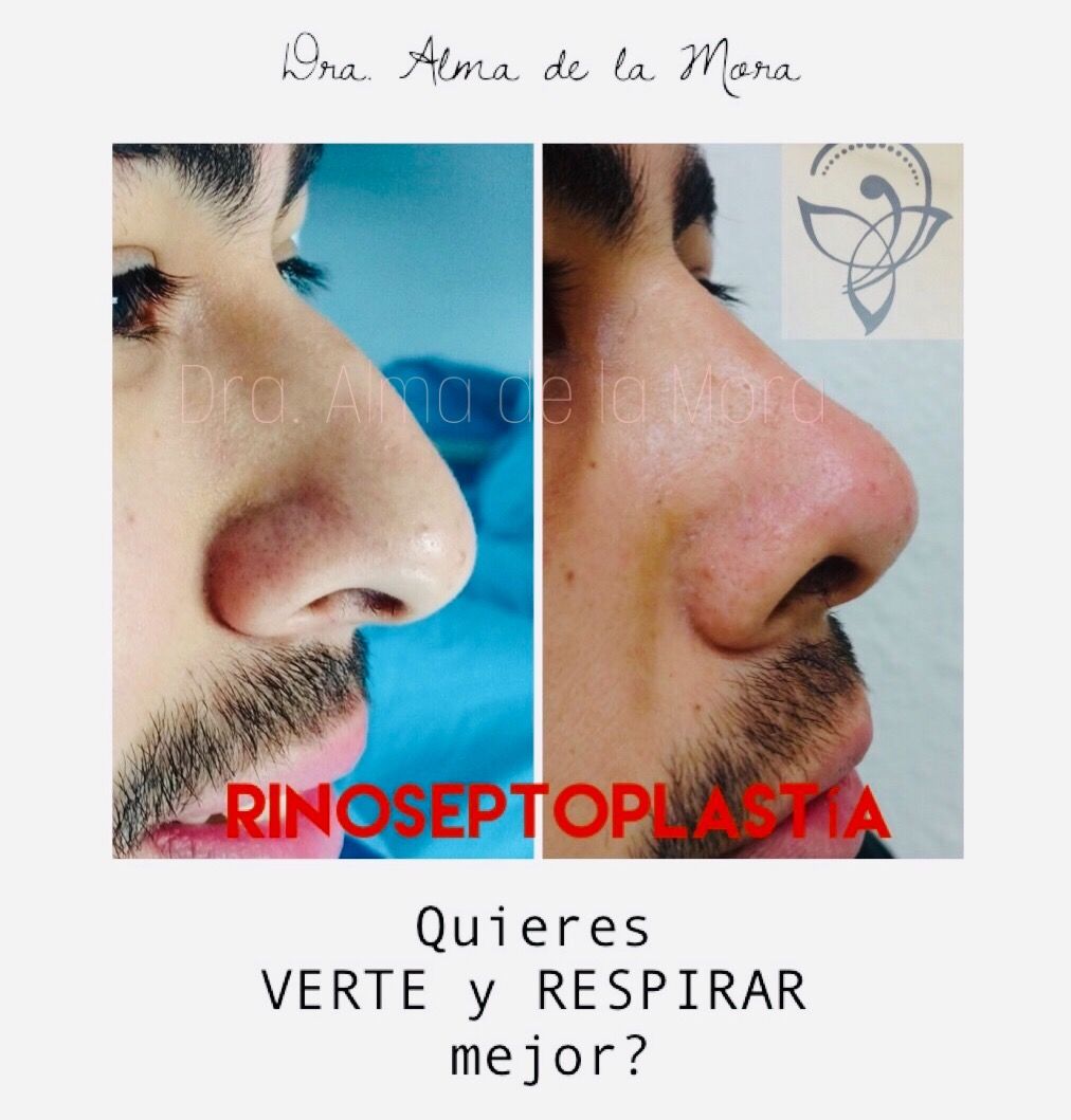 Alma Aidee De La Mora Jimenez-5