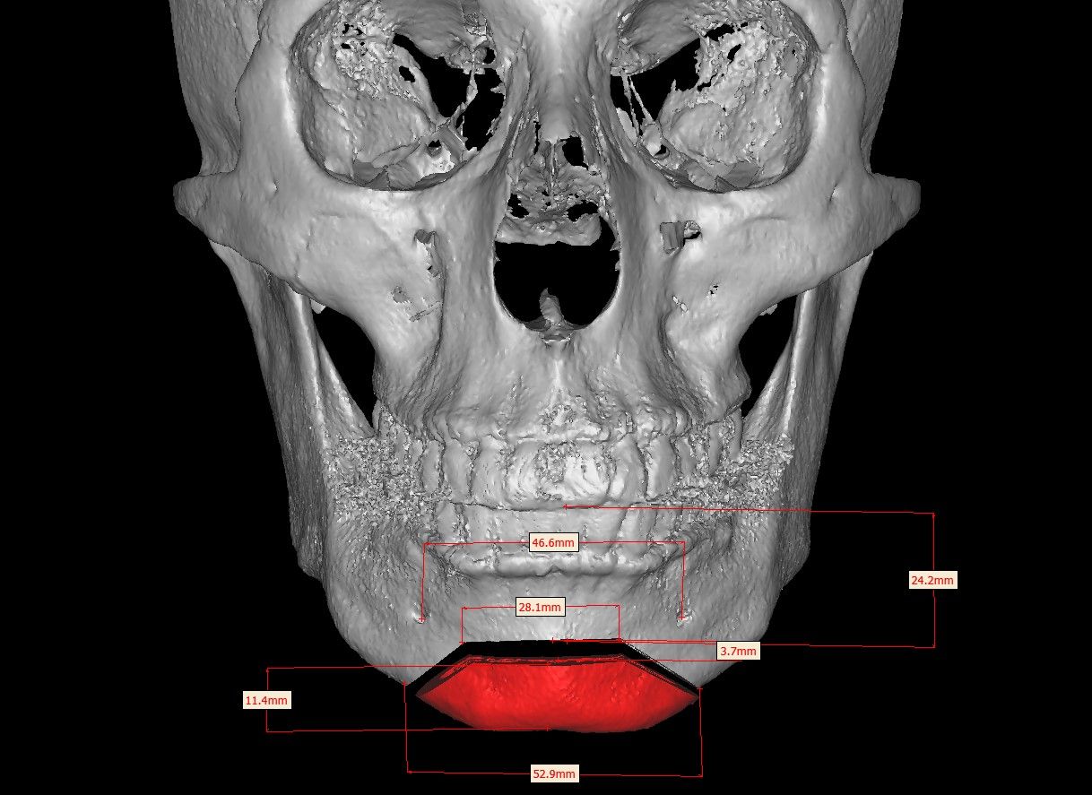 Christian San Juan González-13