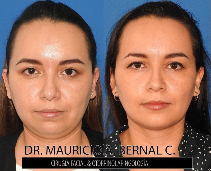 Mauricio Alejandro Bernal Carreon-10