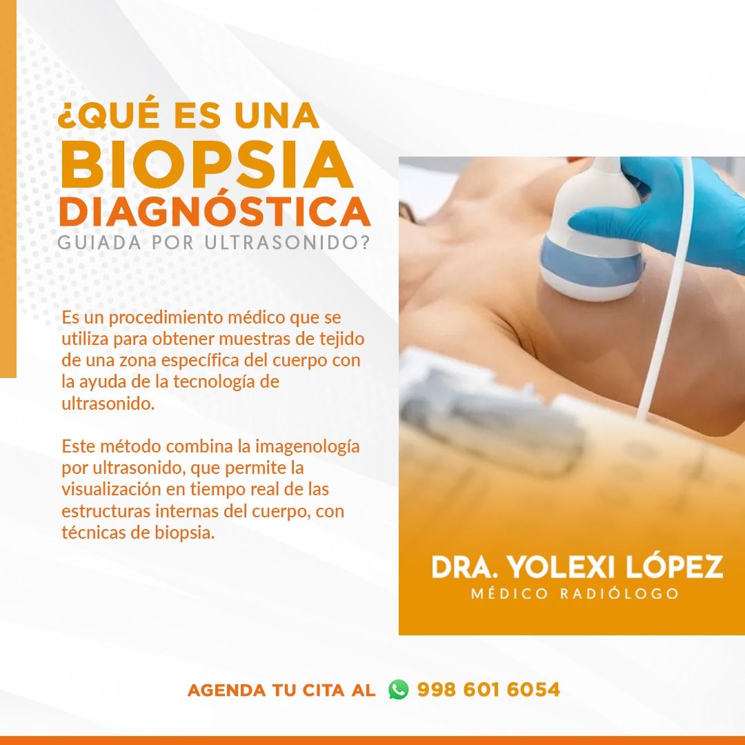 Yolexi López Neyra-2