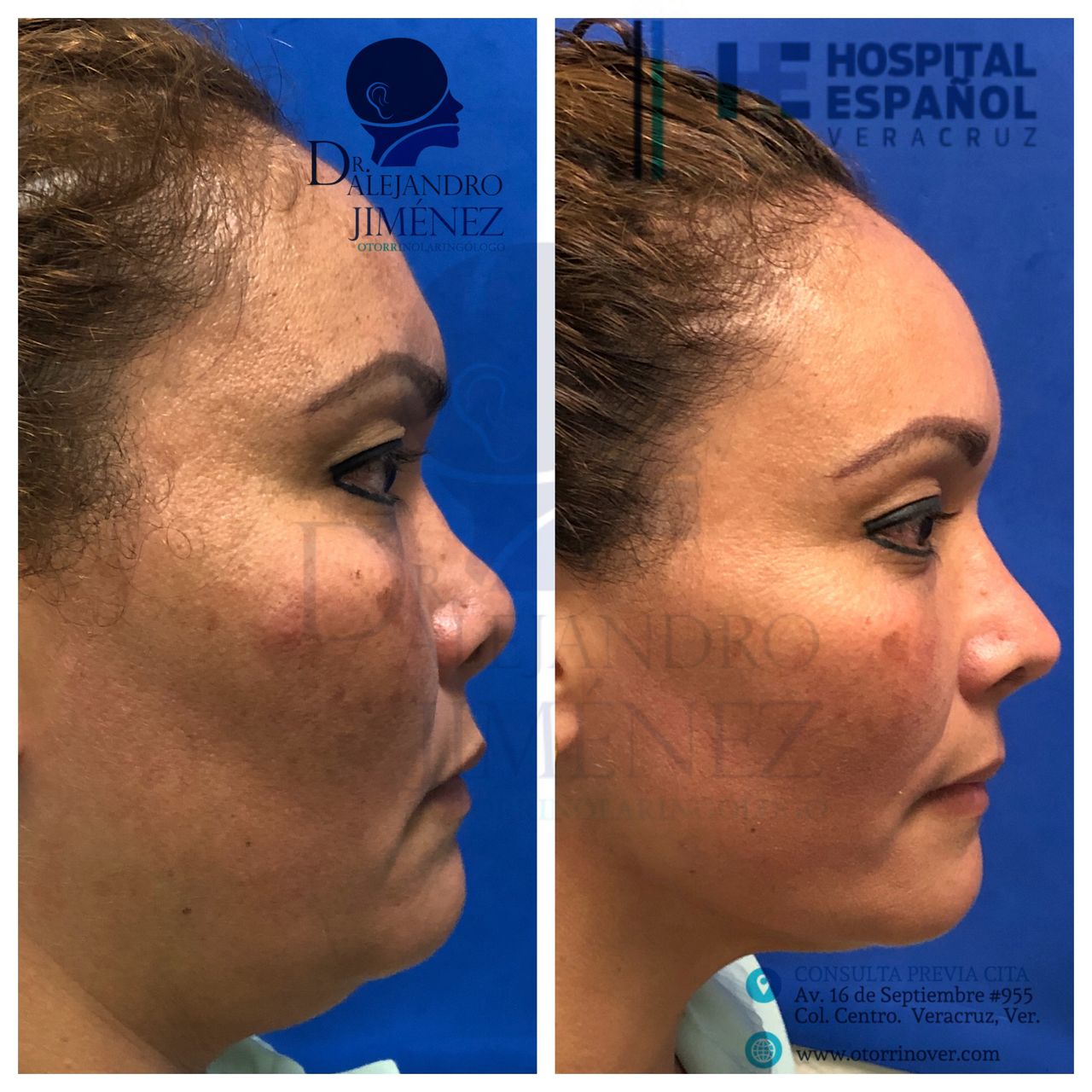 Alejandro Jimenez Garcia-9