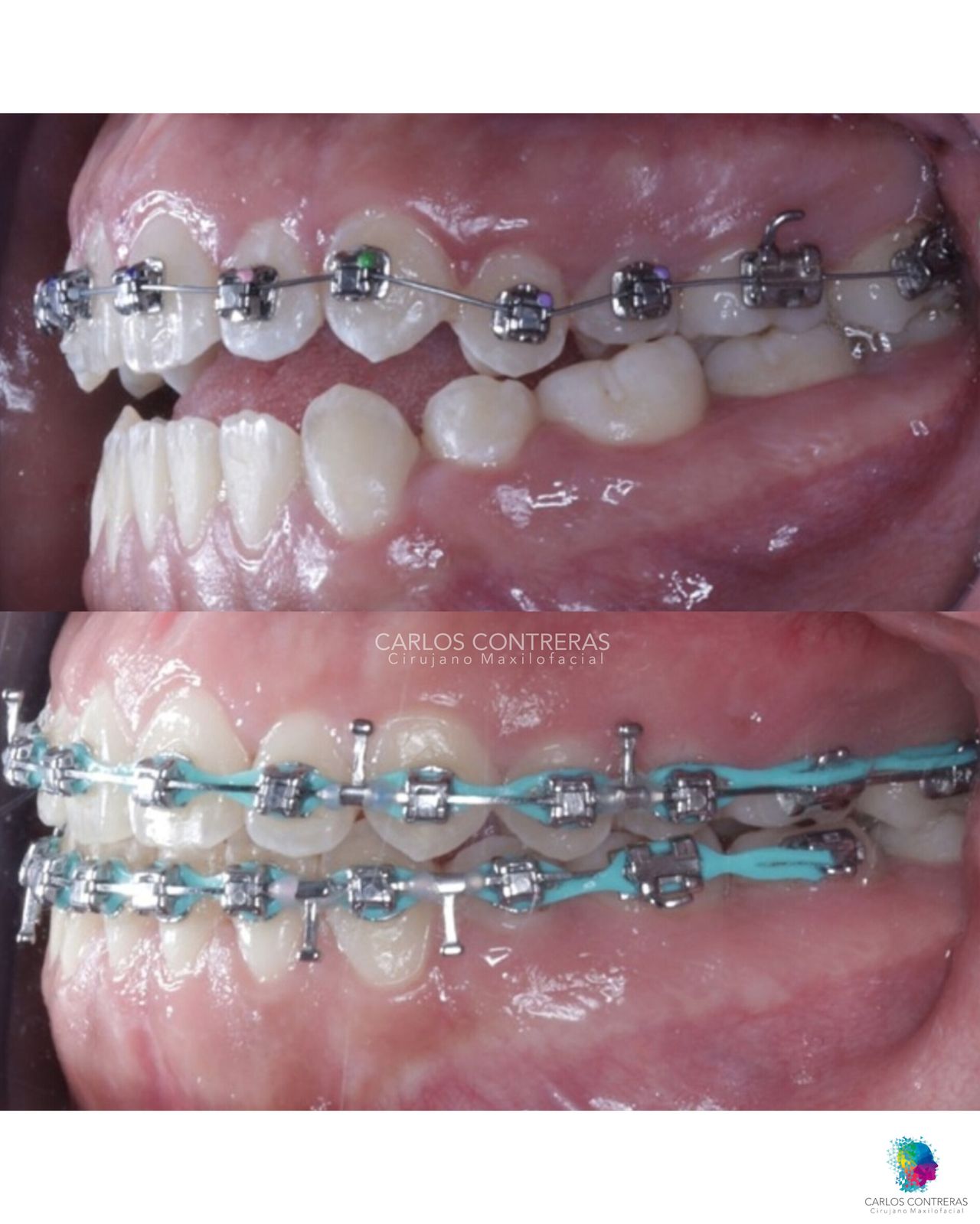 Carlos Ernesto Contreras Castellanos-35