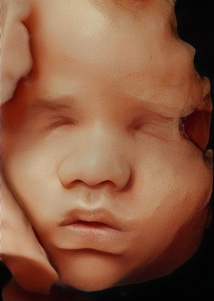 Johnatan Torres Torres-2