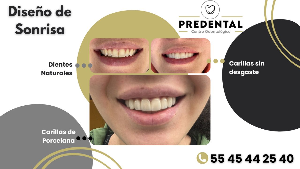 Karla Garnica Elguero-4