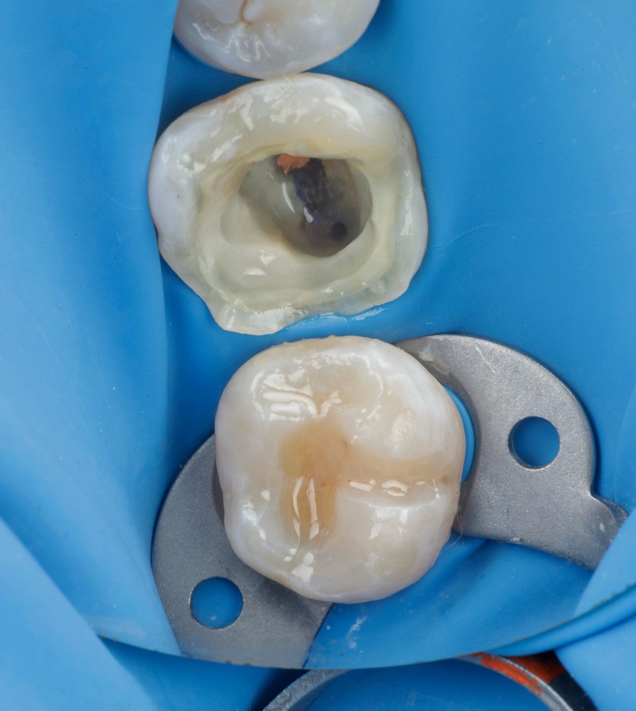 Fredy Alejandro Roblero Gónzalez-45