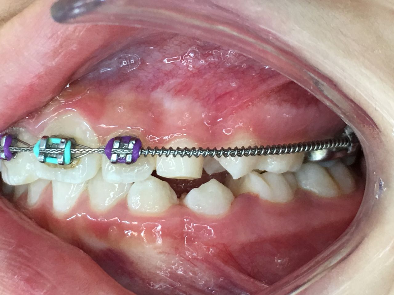 Patricia Rizo Palos-7