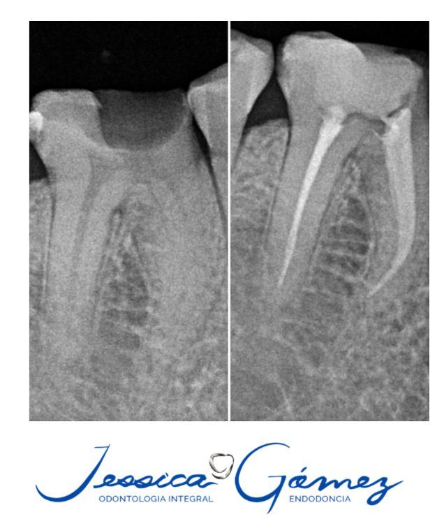 Jessica Gómez Tavizon-10
