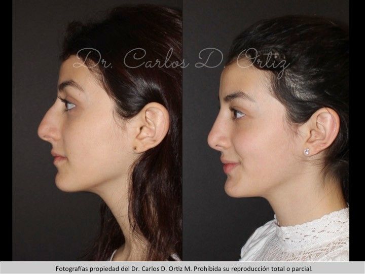 Carlos David Ortiz Moreno-43