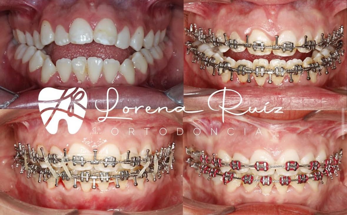 Lorena Ruiz Velazquez-5