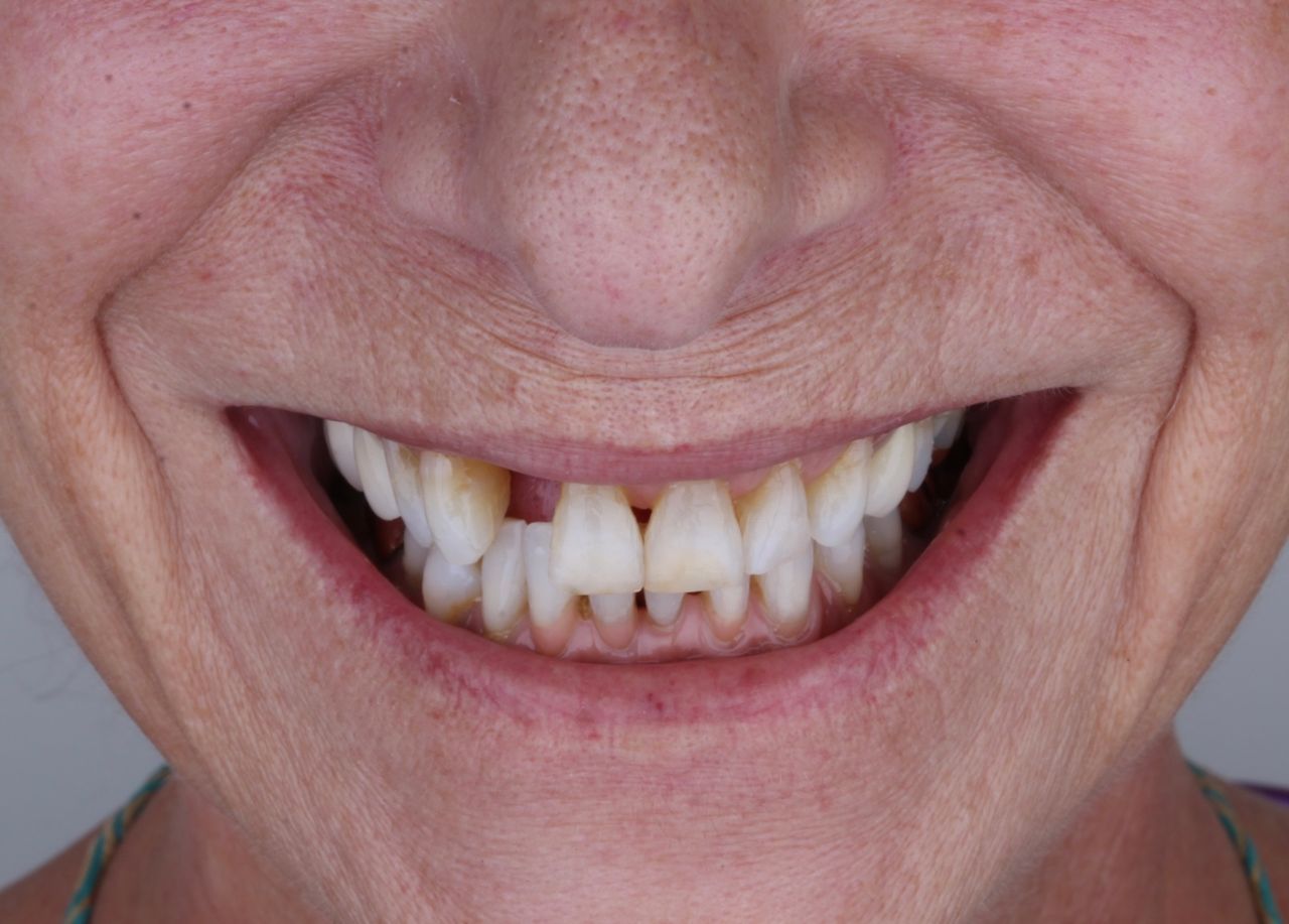 Iliana Astorga Avilez-14