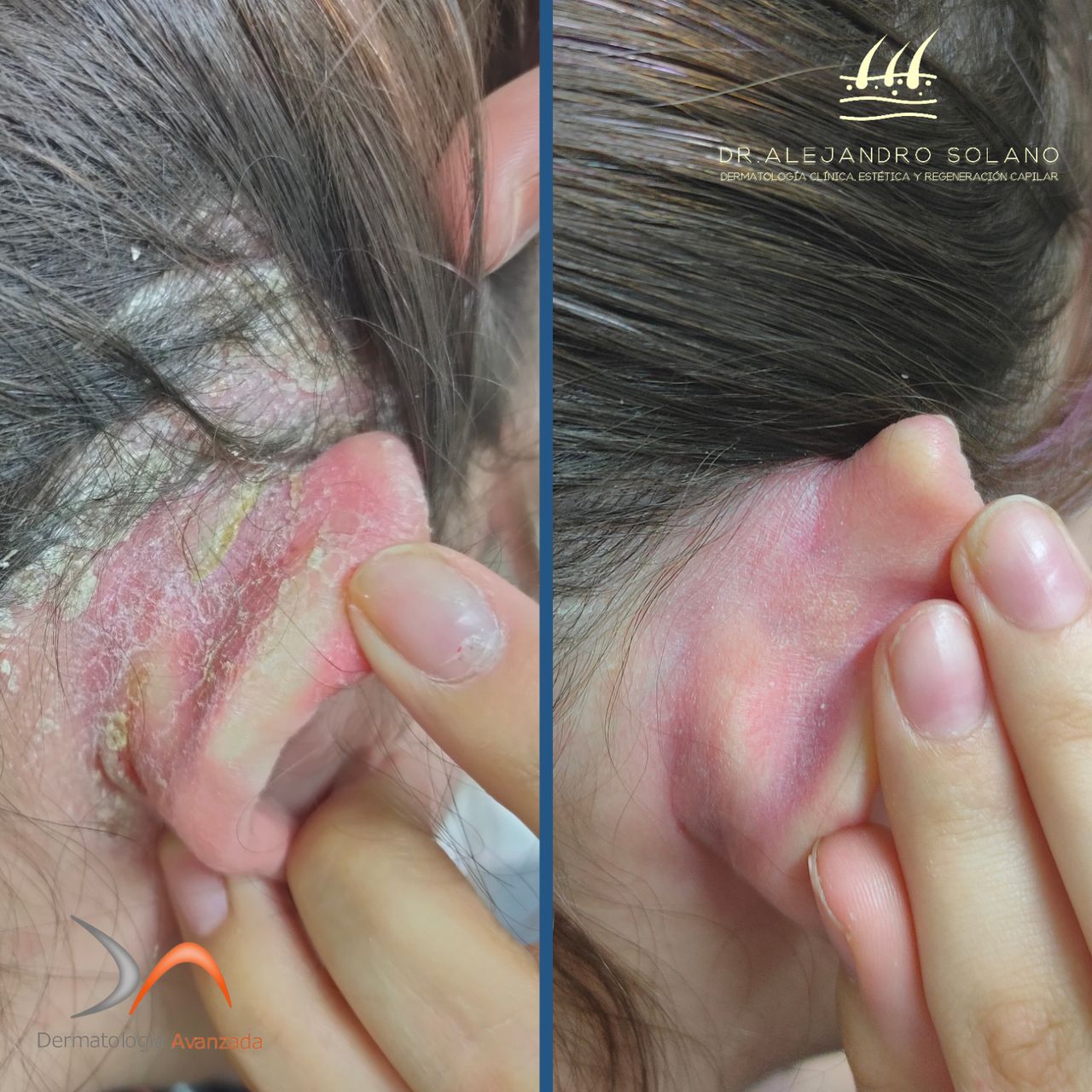 Oscar Alejandro Solano Anguiano-19