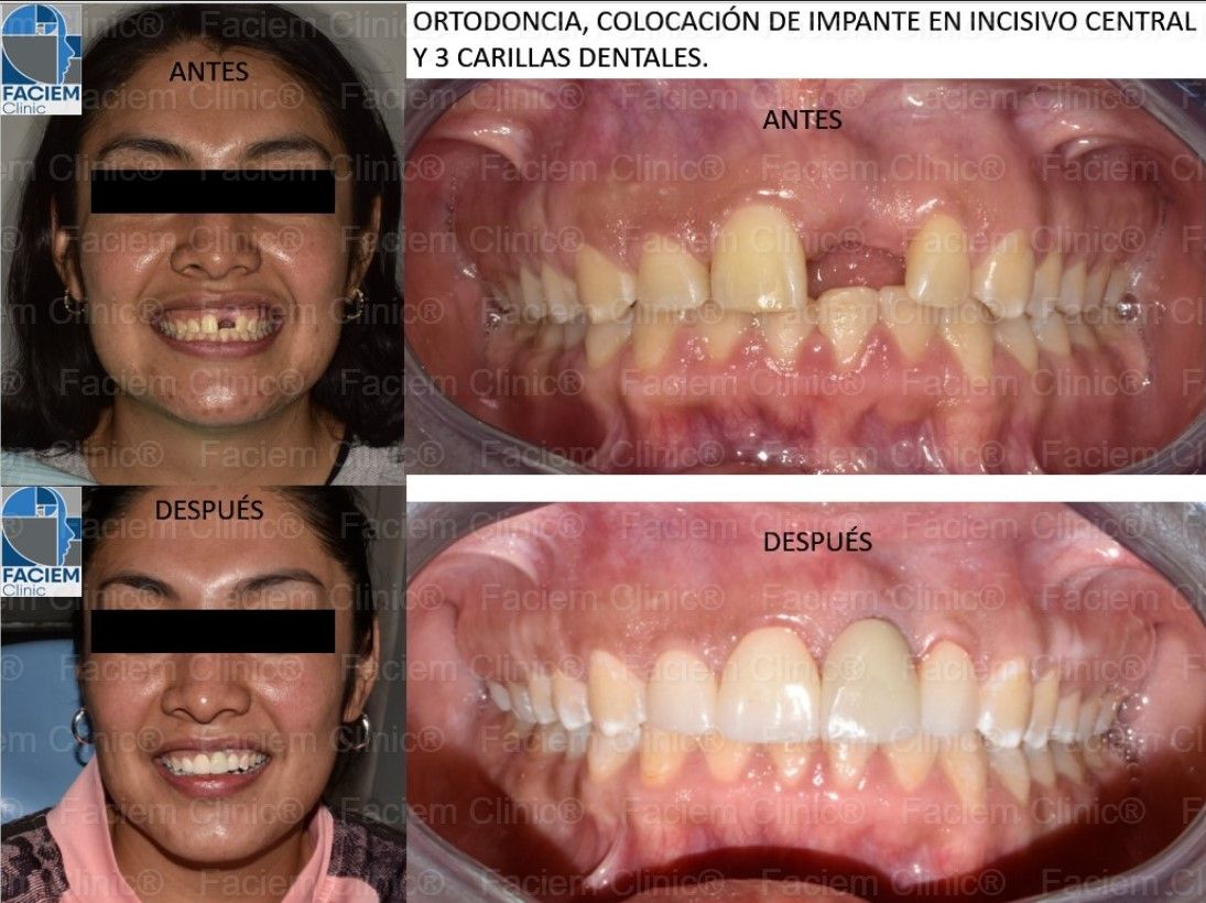 Arlen Colín Ordaz-13