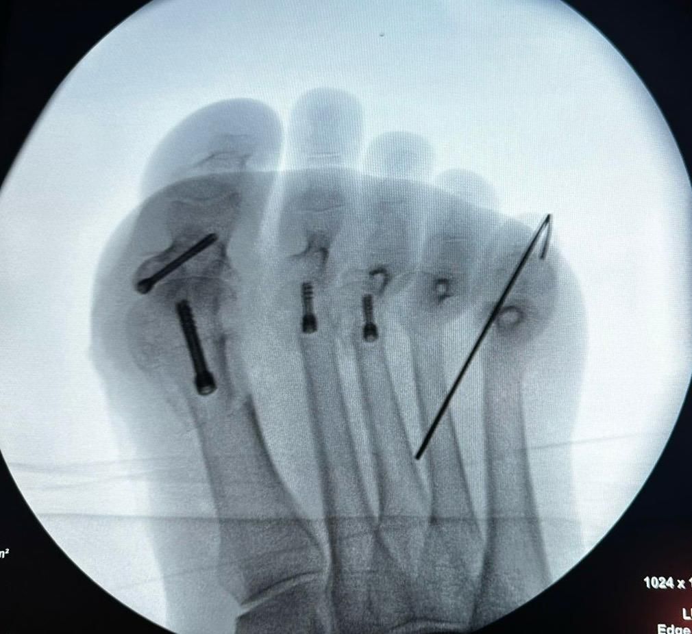 Juan Pedro Martínez Ávila-6