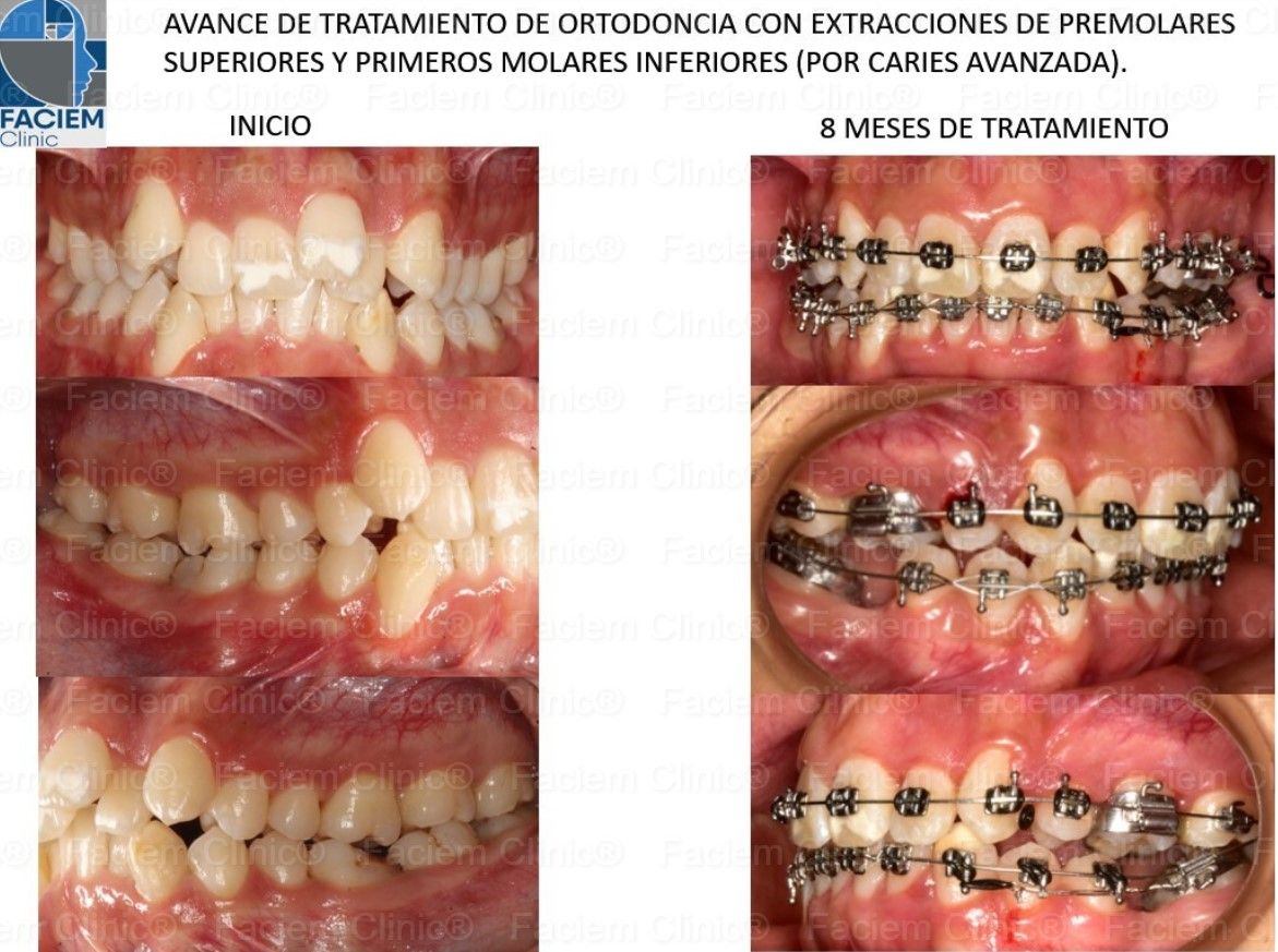 Ricardo Parra García-8