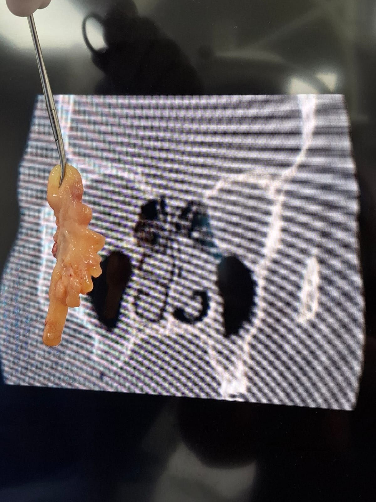 Martin Alberto Hernandez Cardenas-10