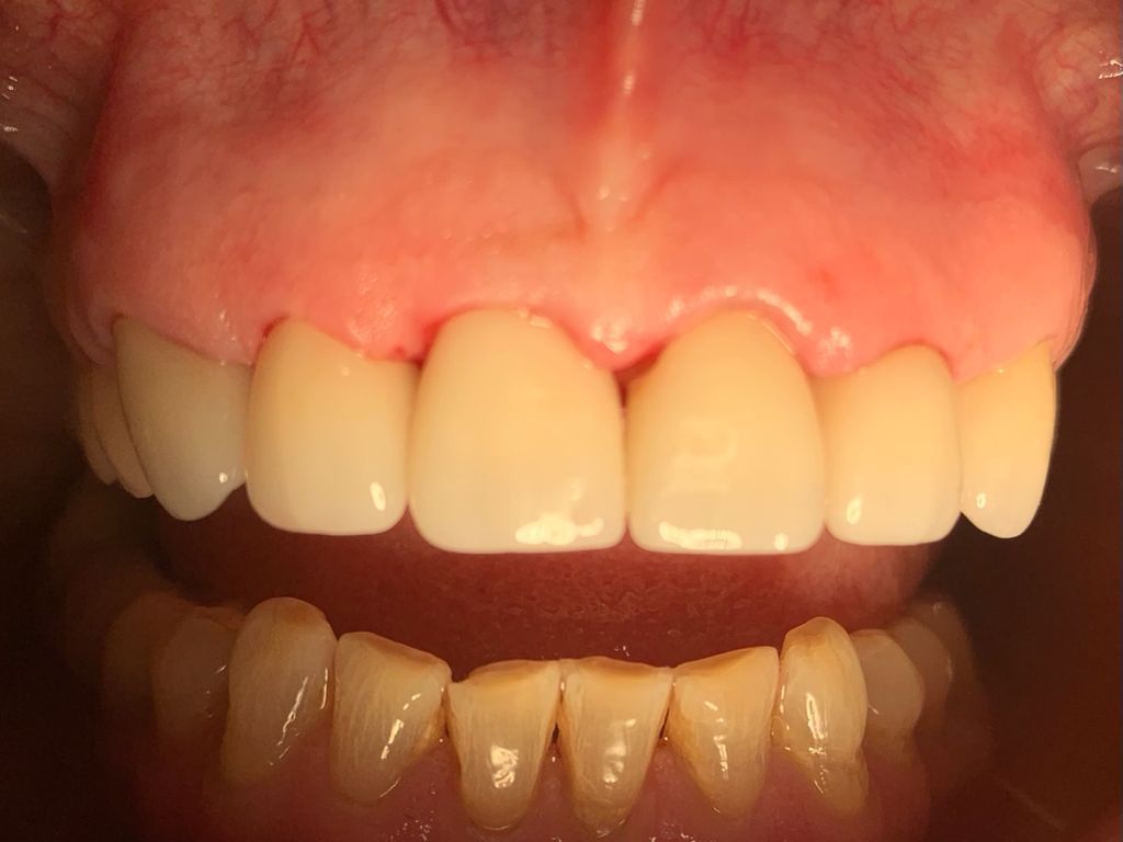 Yuriria Gochy Escalante-14