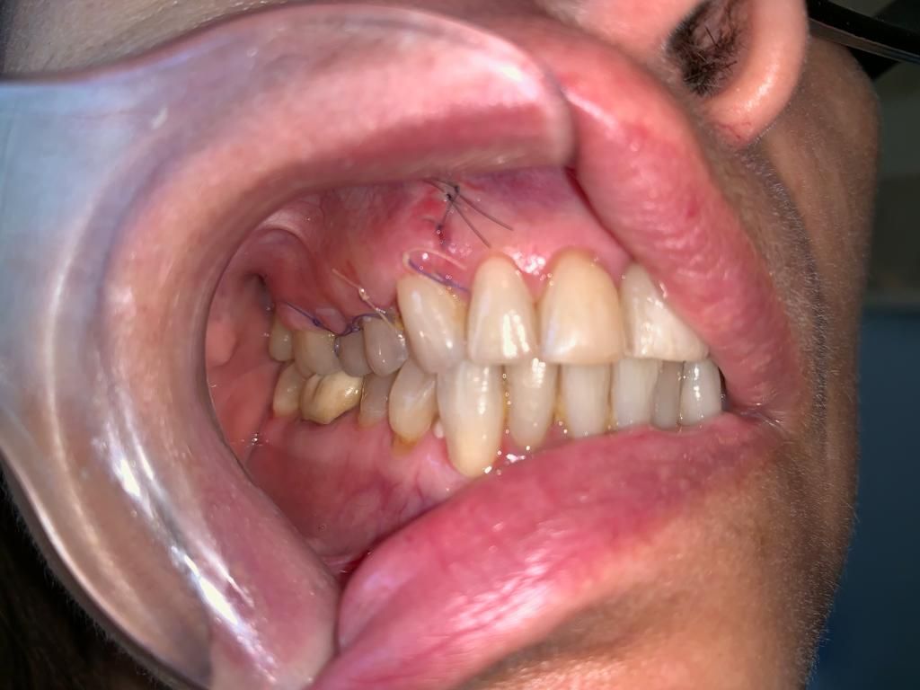 Sergio David Duarte García-3