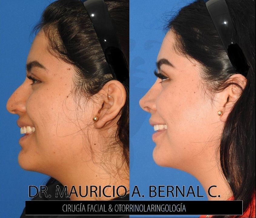 Mauricio Alejandro Bernal Carreon-17