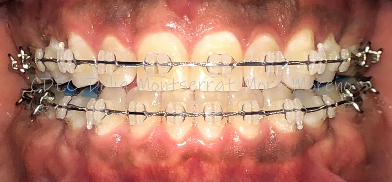 Delia Montserrat Mora Moreno-5