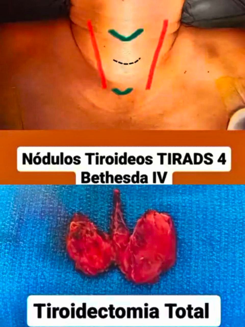 Ulises Mazariegos-11