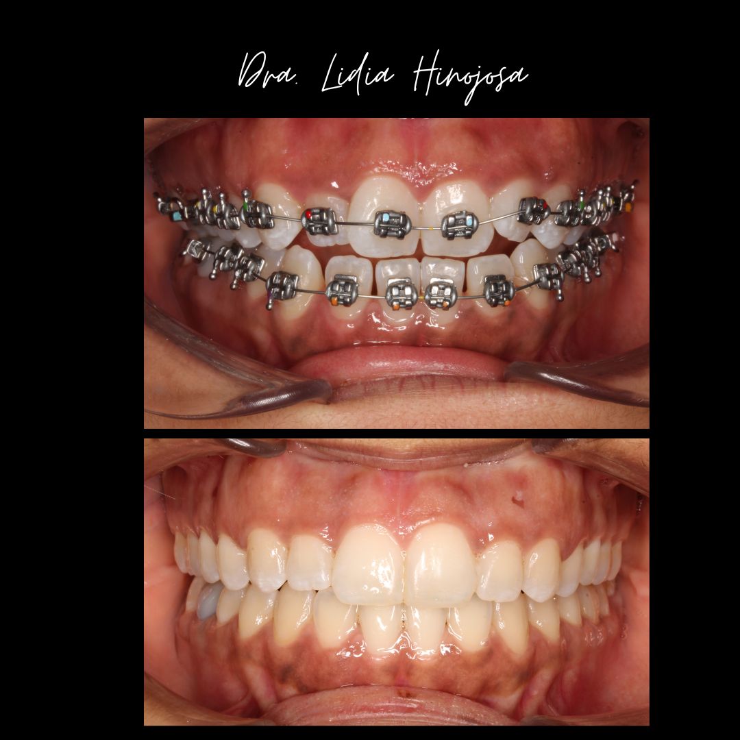 Lidia Abigail Hinojosa Arellanes-22