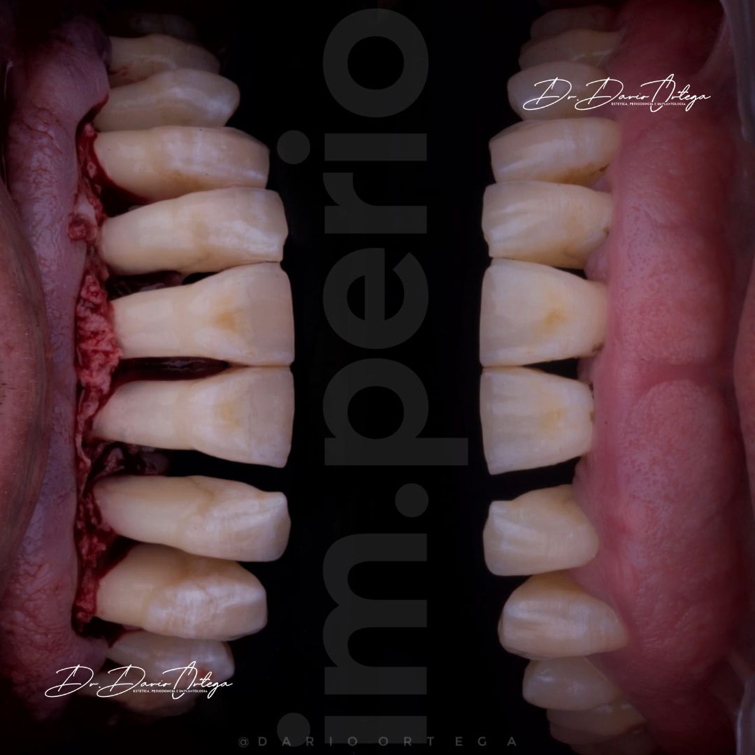 Dario Ortega Aceves-19