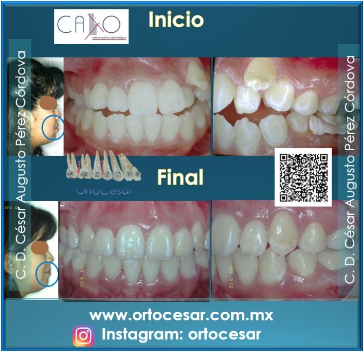 César Augusto Pérez Córdova-17