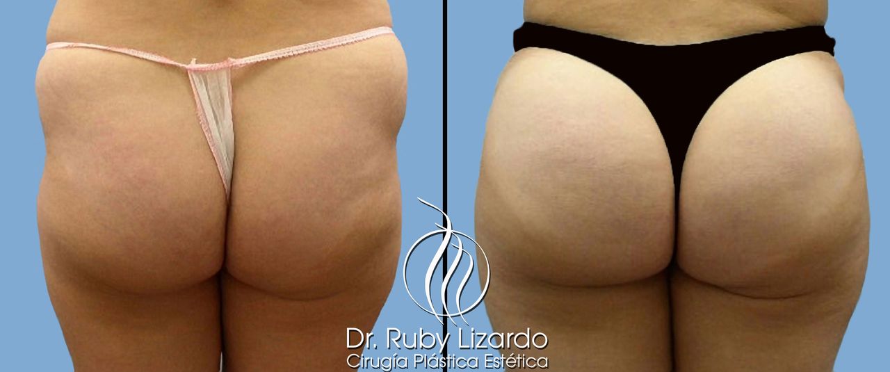 Ruby Lizardo Ramírez Robles-19