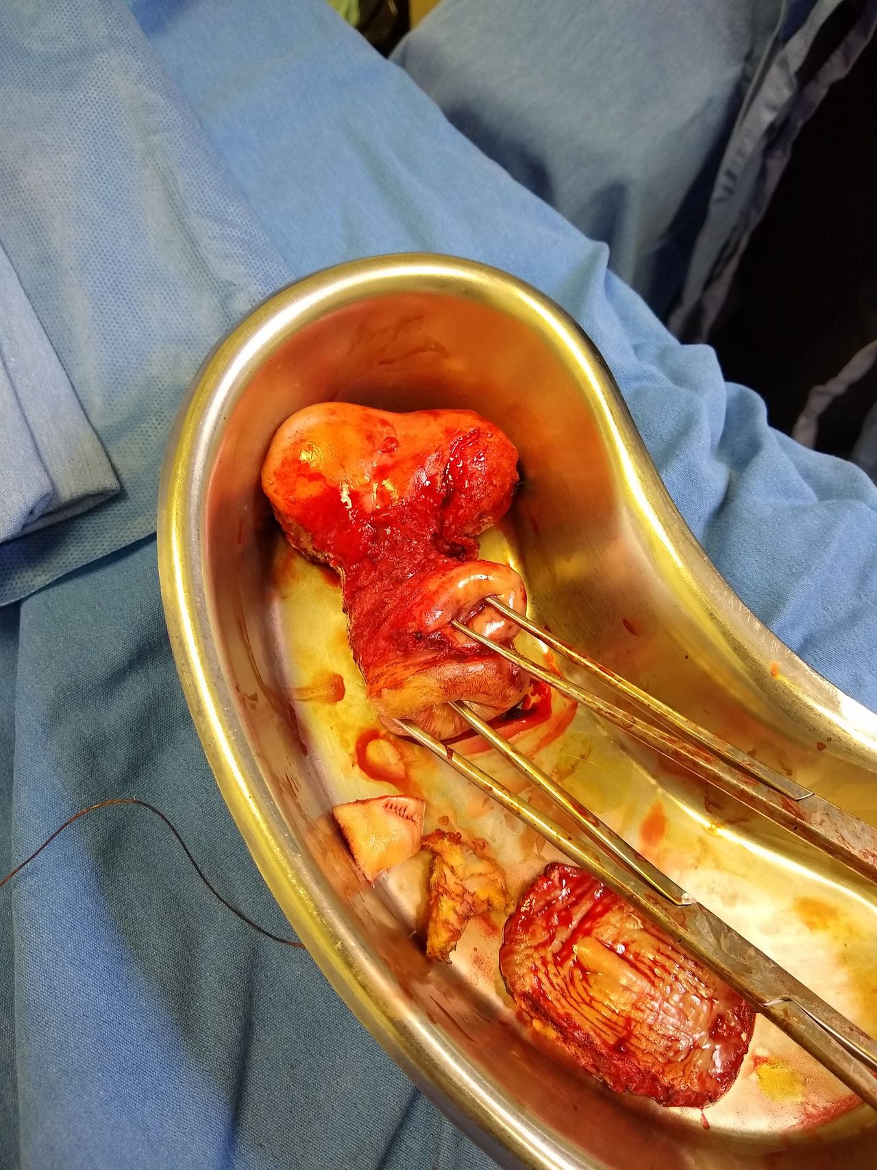 Mayra Elizabeth Tejeda Ceja-2