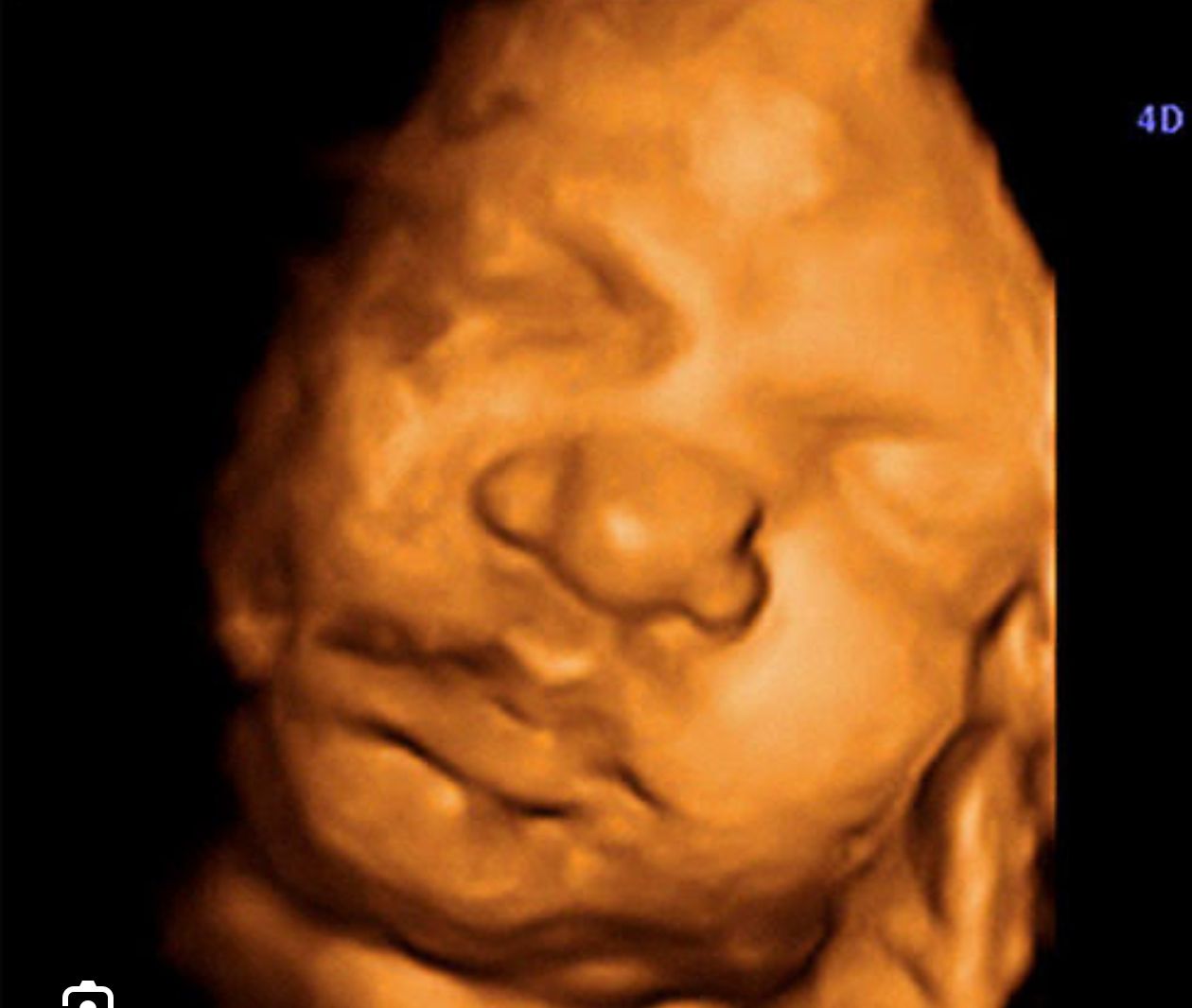 Juan Angel Garcia Castro-6