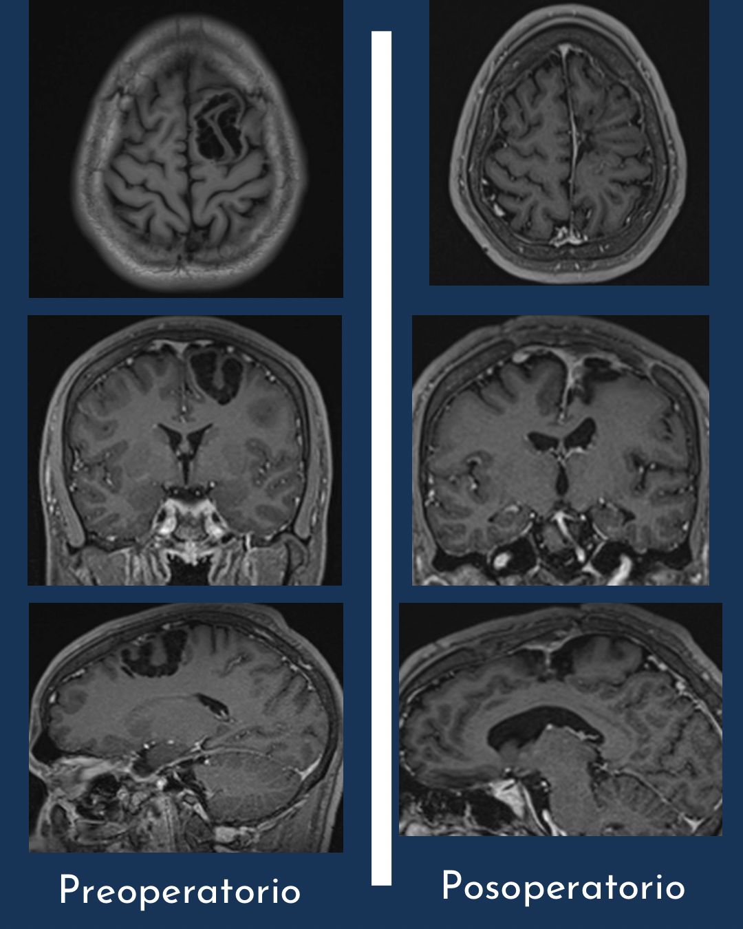 Alejandro Ceja Espinosa-3
