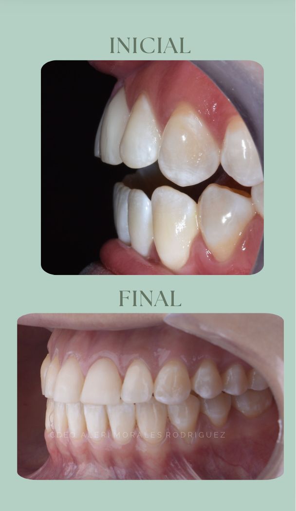 Alerí Morales Rodríguez-4