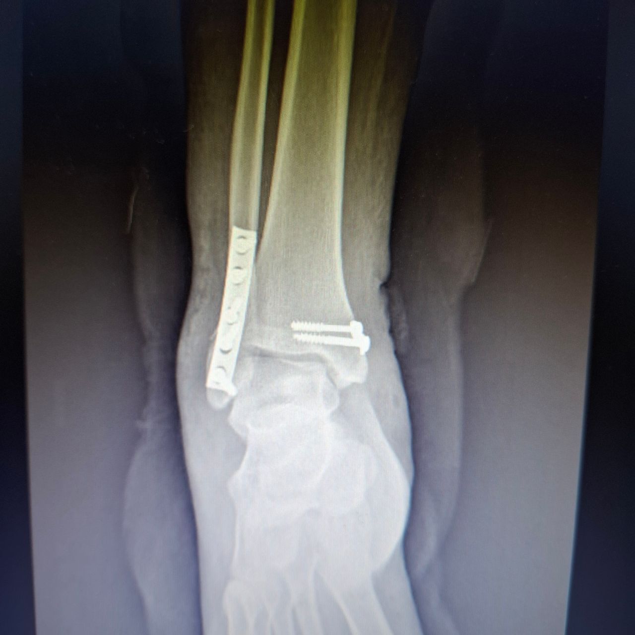 Carlos Eduardo Chairez Leyva-2