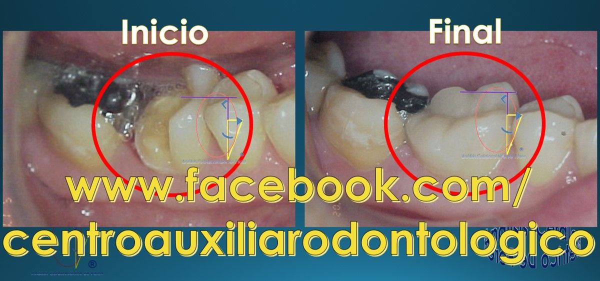 César Augusto Pérez Córdova-46