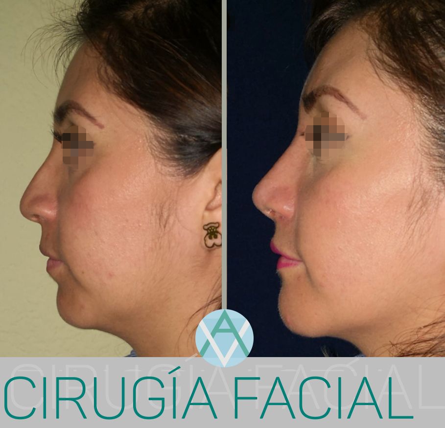 Alfonso Villaseñor Herrero-30