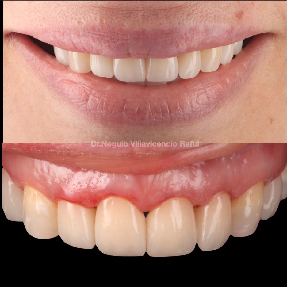 Neguib Villavicencio Raful-52