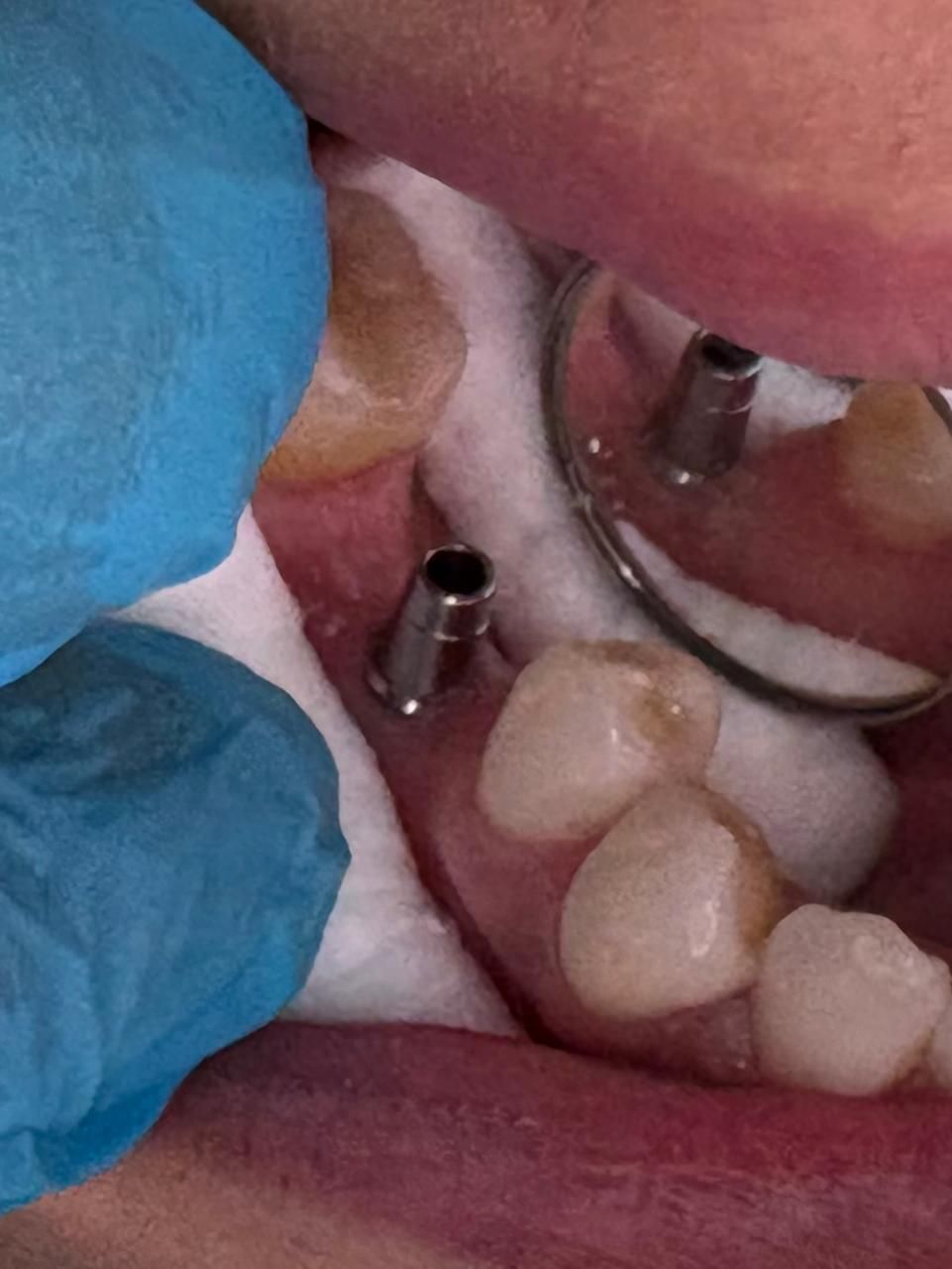 Arturo Romero Grande-30