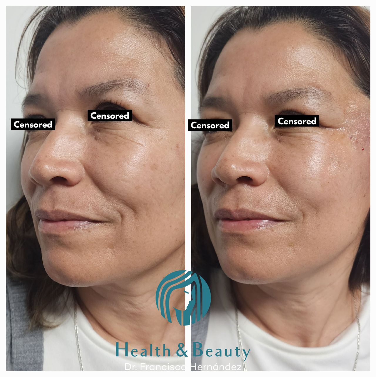 Francisco Hernández Gómez Crespo-74