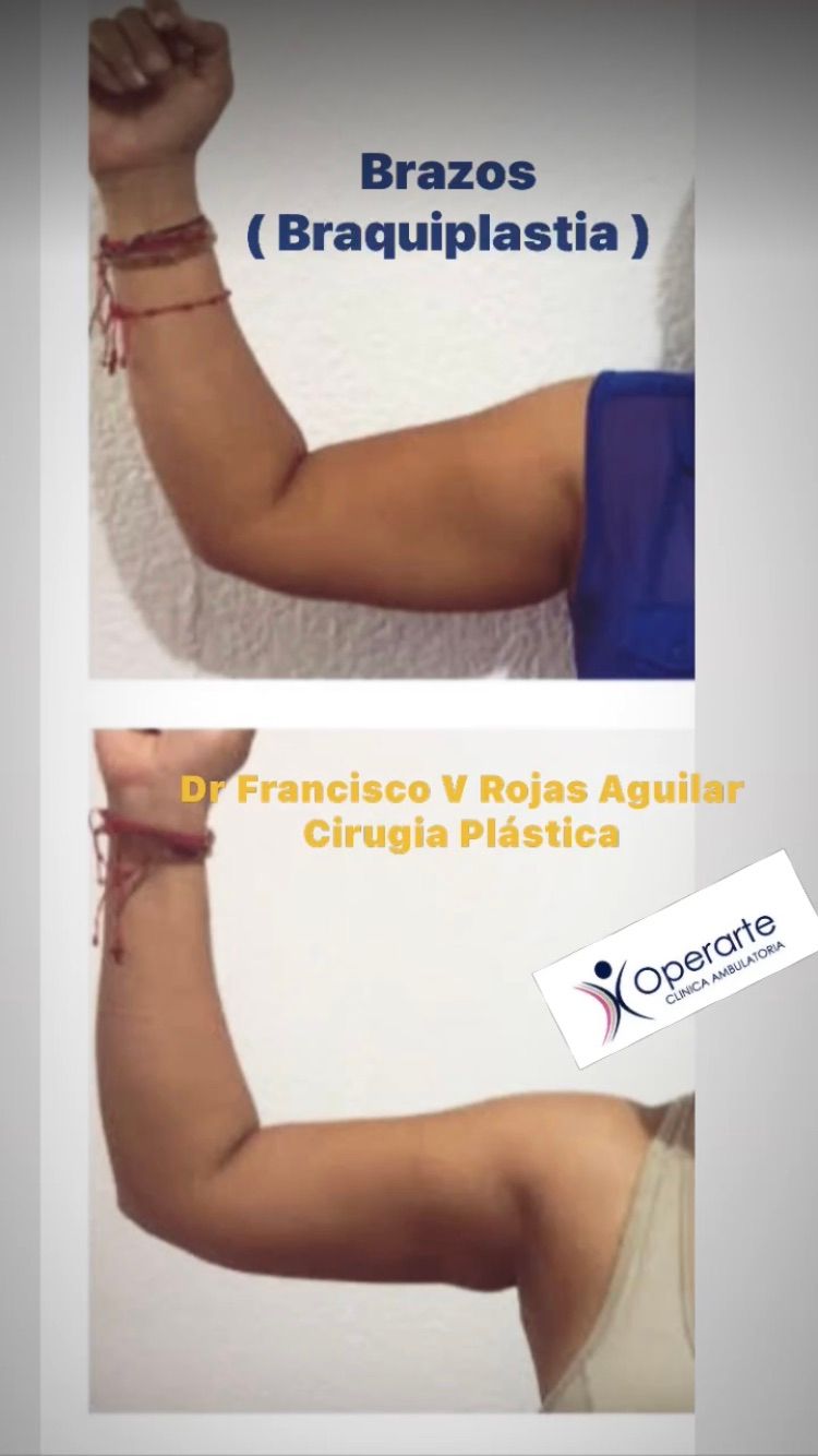 Francisco Rojas Aguilar-3