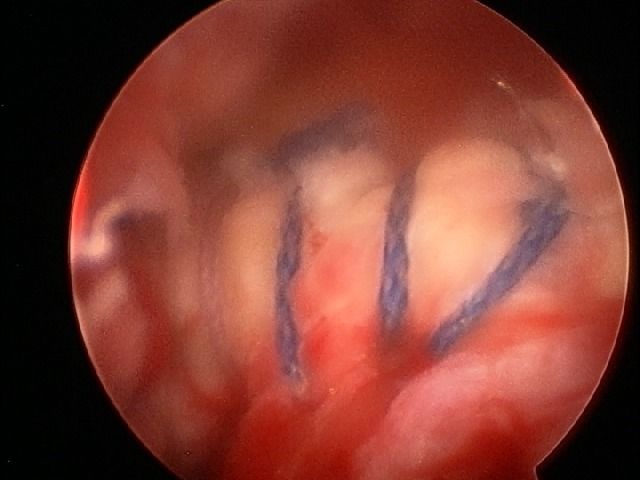 José Antonio Algarín Reyes-49