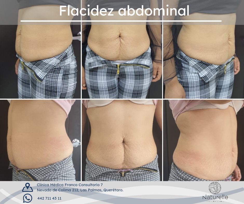 Daniel Marín Jasso-21