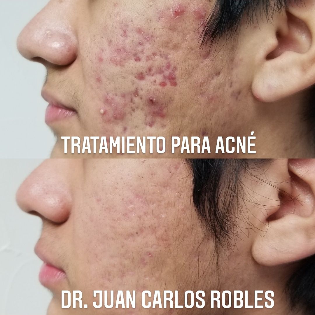 Juan Carlos Robles Méndez-25