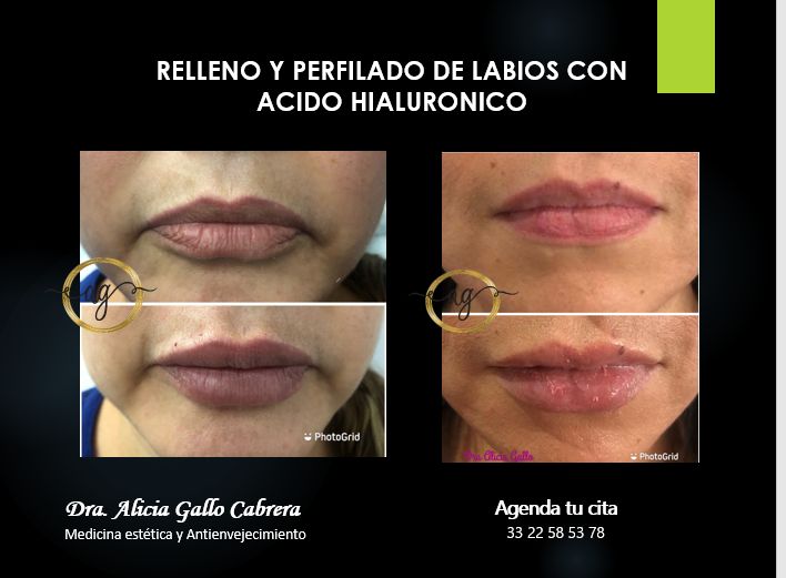 Alicia Gallo Cabrera-3