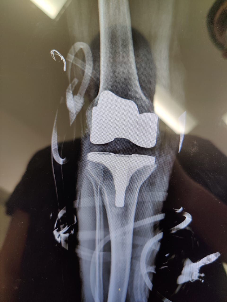 Manuel Alejandro Villagrán Luján-3