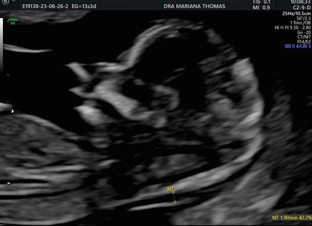 Mariana Thomas García-1