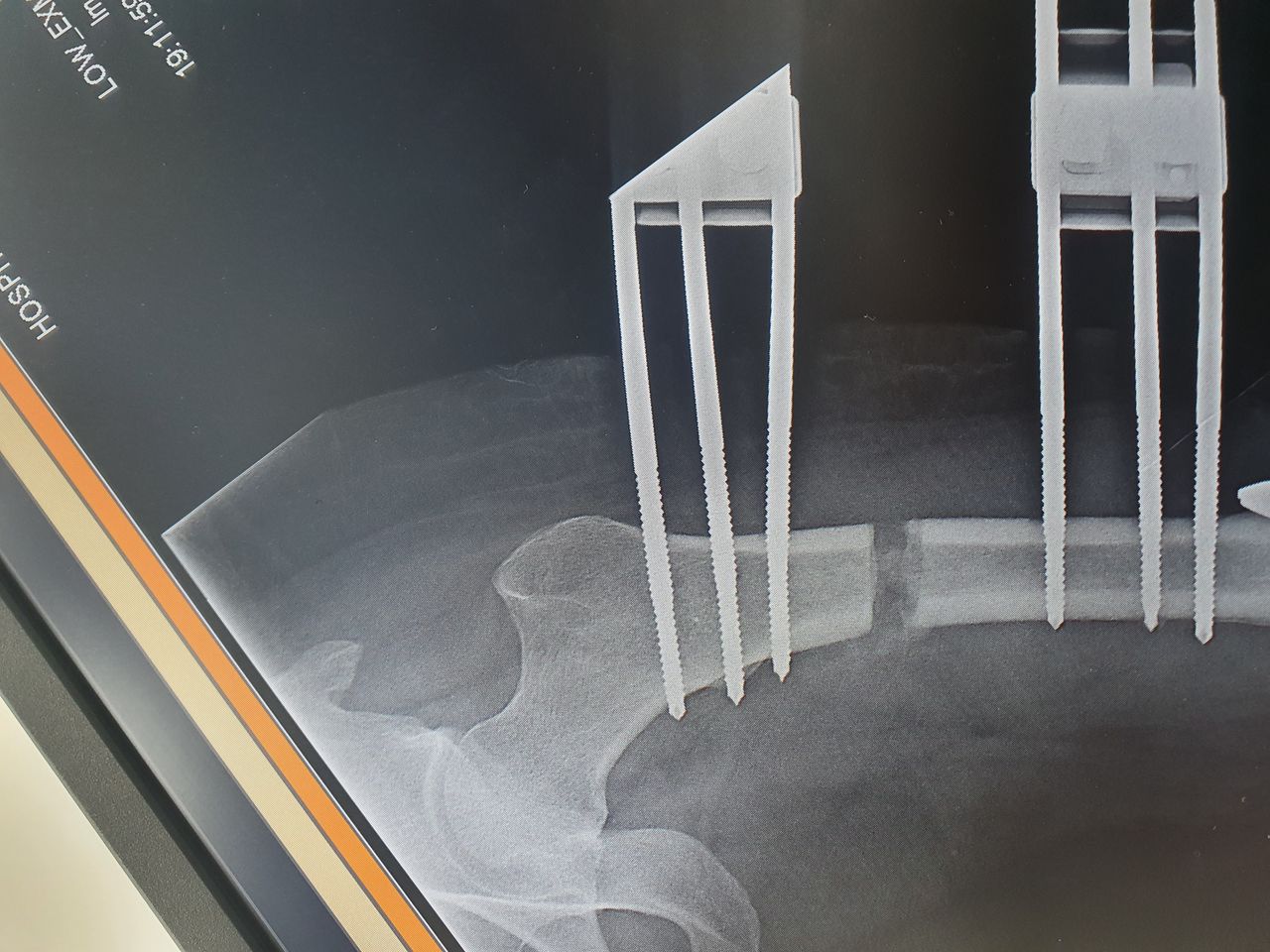 Carmen Yossaleth Briceño González-4