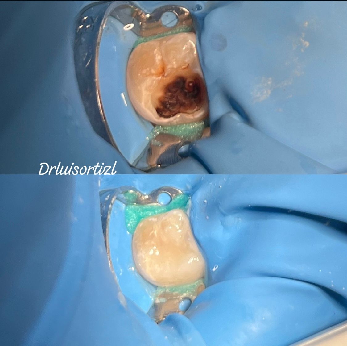 Luis Ángel Ortiz López-13