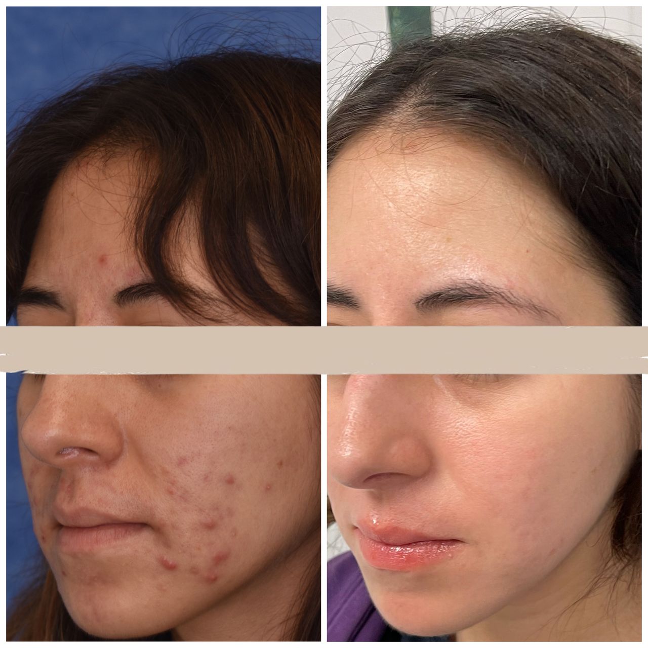 Laura Mora Montero-2