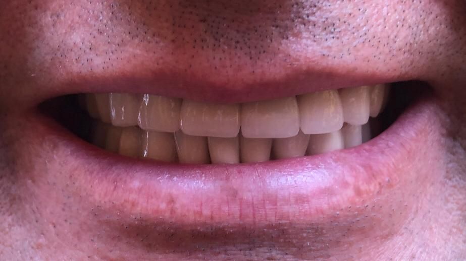 Zuleica Vera Apan-71